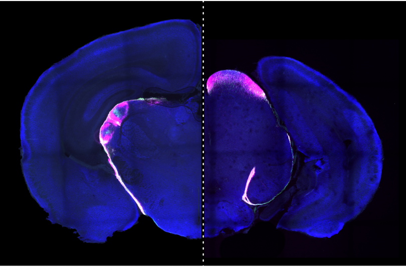 Pictured is a color enhanced mouse brain.