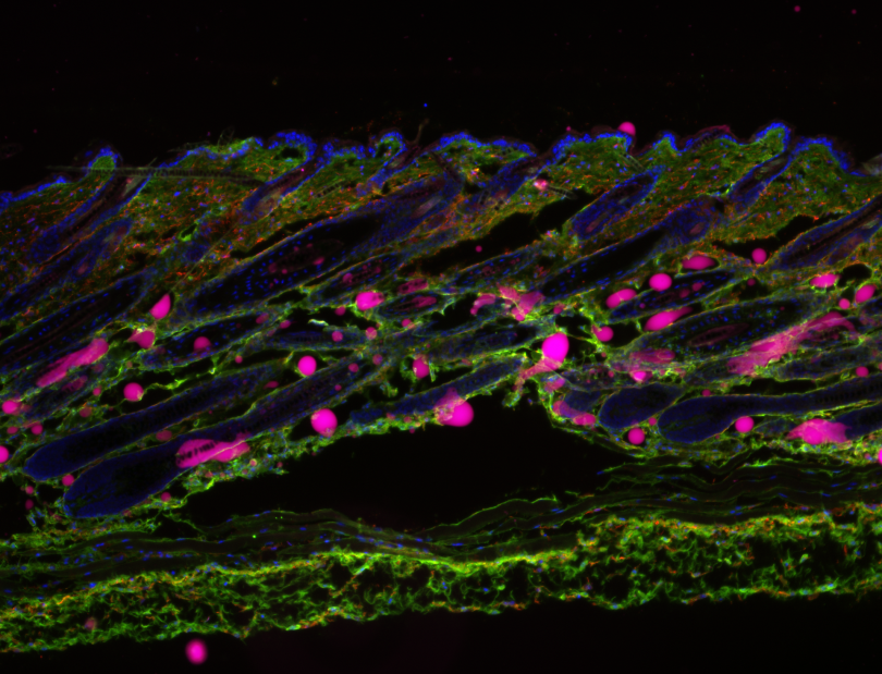 A picture of mouse skin with hair follicles.